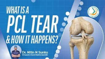 Common Causes of Meniscus Tears in Active Adults